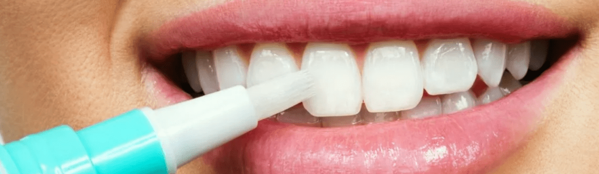 Домашнее отбеливание зубов