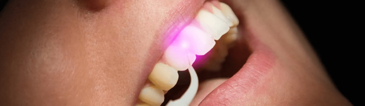 Лазерная стоматология