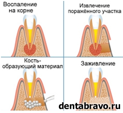 Зубосохраняющие операции в Москве