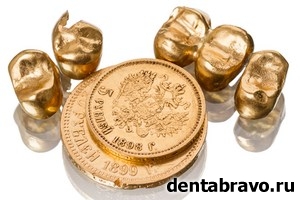Цельнометаллические зубные протезы