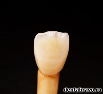 Современные зубные протезы